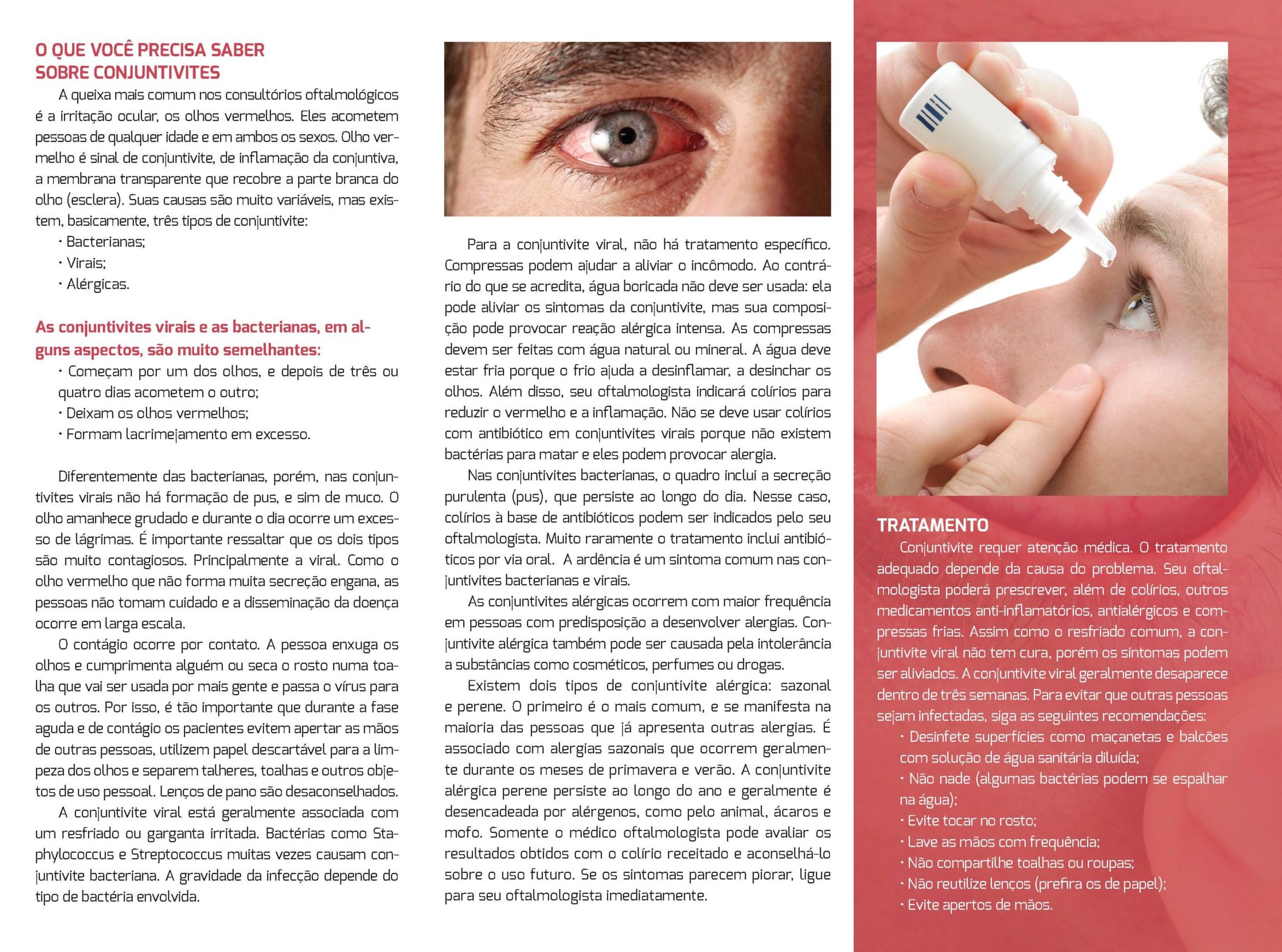 Conjuntivite