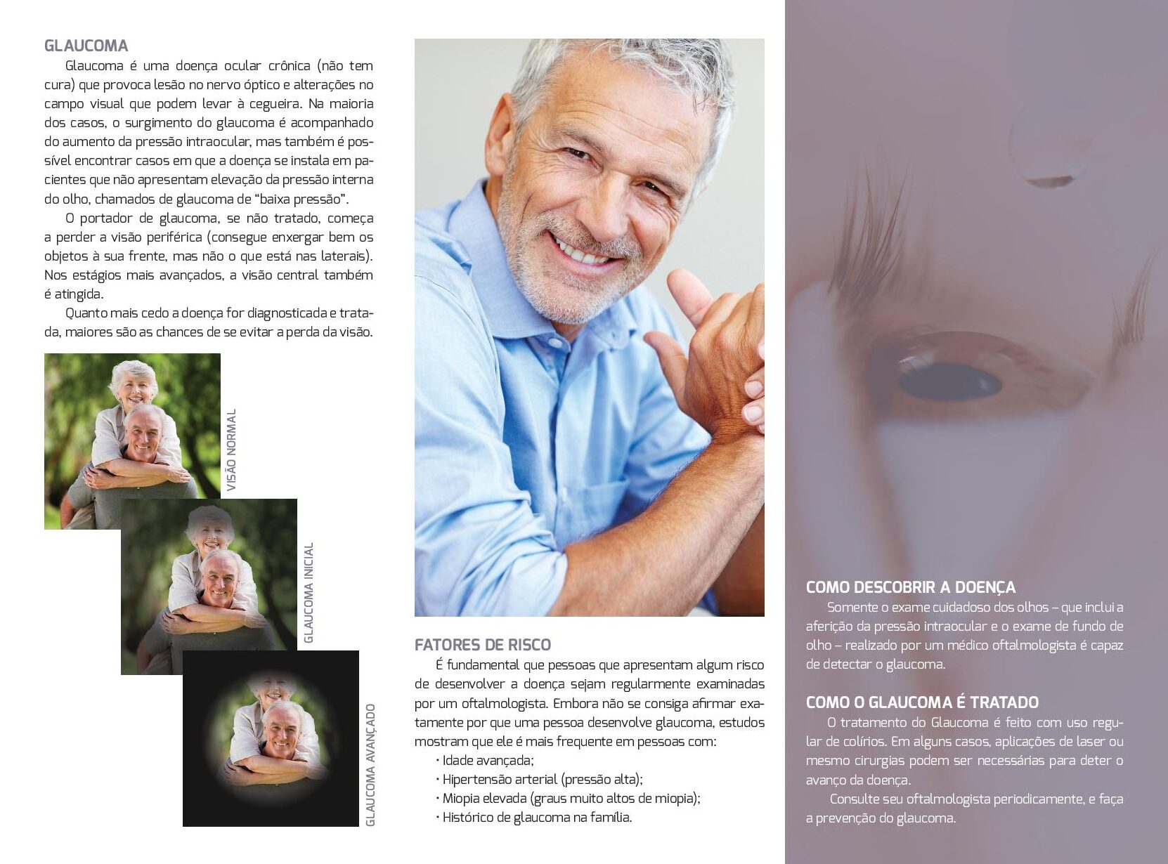 Glaucoma